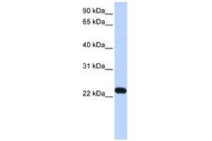 Image no. 1 for anti-Hepatitis B Virus X-Interacting Protein (HBXIP) (N-Term) antibody (ABIN6743628) (HBXIP Antikörper  (N-Term))