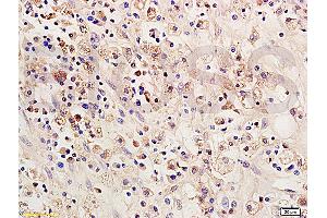 Formalin-fixed and paraffin embedded: rat brain tissue labeled with Anti-SOCS 1 Polyclonal Antibody (ABIN725135), Unconjugated 1:200 followed by conjugation to the secondary antibody and DAB staining (SOCS1 Antikörper  (AA 121-211))