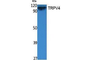 Western Blotting (WB) image for anti-Transient Receptor Potential Cation Channel, Subfamily V, Member 4 (TRPV4) (Internal Region) antibody (ABIN3187608) (TRPV4 Antikörper  (Internal Region))