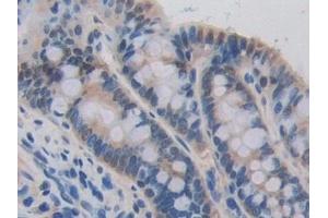 Immunohistochemistry (IHC) image for anti-Cadherin-16 (CDH16) (AA 353-617) antibody (ABIN7441937)