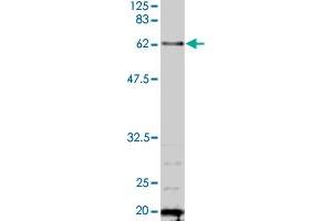Detection of TAF6 by Western blotting using the TAF6 polyclonal antibody  . (TAF6 Antikörper  (AA 1-200))