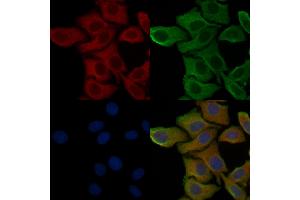 ABIN6258991 and ABIN6276088 staining Hela cells by IF/ICC.