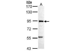 WB Image Sample (30 ug of whole cell lysate) A: A431 , 7. (PFKM Antikörper  (N-Term))