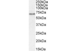 ABIN870680 (1µg/ml) staining of Rat Kidney lysate (35µg protein in RIPA buffer). (SLC5A1 Antikörper  (Internal Region))
