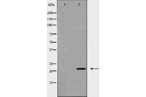 Western blot analysis of VEGFB expression in Jurkat cells,The lane on the left is treated with the antigen-specific peptide.