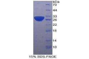 SDS-PAGE analysis of Human B-Cell Linker Protein. (B-Cell Linker Protein (BLNK))