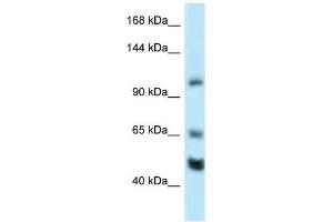Western Blot showing Rest antibody used at a concentration of 1. (REST Antikörper  (Middle Region))