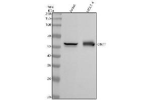 Western blot analysis of TDT using anti-TDT antibody (ABIN7606472).
