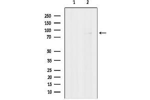 anti-Olfactomedin-Like 2B (OLFML2B) (Internal Region) antibody