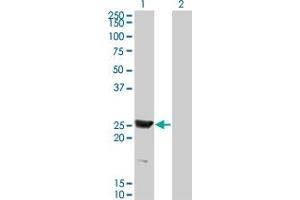 Western Blot analysis of RAB15 expression in transfected 293T cell line by RAB15 monoclonal antibody (M01), clone 1G12. (RAB15 Antikörper  (AA 99-208))