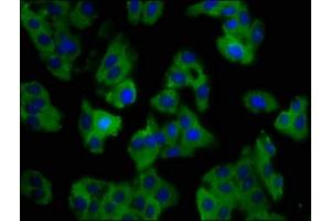 Immunofluorescence staining of HepG2 cells with ABIN7161089 at 1:100, counter-stained with DAPI. (SLC11A1 Antikörper  (AA 1-58))