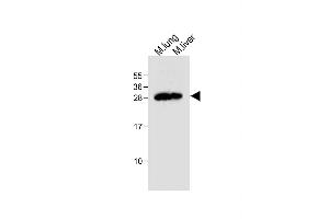 All lanes : Anti-Mouse Trem2 Antibody (N-term) at 1:500 dilution Lane 1: Mouse lung tissue lysate Lane 2: Mouse liver tissue lysate Lysates/proteins at 20 μg per lane. (TREM2 Antikörper  (N-Term))