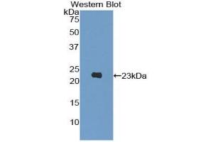 Detection of Recombinant PIK3Cb, Human using Polyclonal Antibody to Phosphoinositide-3-Kinase Catalytic Beta Polypeptide (PIK3Cb) (PIK3CB Antikörper  (AA 321-507))