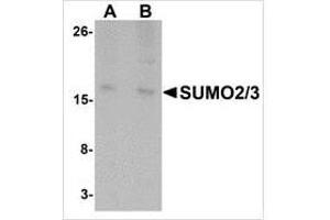 Western blot analysis of SUMO3 in rat liver tissue lysate with SUMO3 antibody at (A) and (B) 2 μg/ml. (SUMO2 Antikörper  (C-Term))