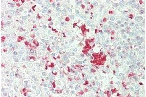 Human Spleen: Formalin-Fixed, Paraffin-Embedded (FFPE) (FBXL5 Antikörper  (AA 510-691))