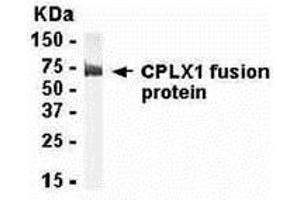 Western Blotting (WB) image for anti-Complexin 1 (CPLX1) (AA 1-134) antibody (ABIN2468059) (Complexin 1 Antikörper  (AA 1-134))