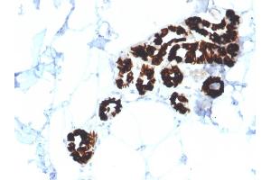 Immunohistochemistry (IHC) image for anti-Keratin 15 (KRT15) antibody (ABIN6939912)