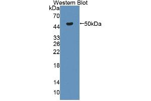 Western blot analysis of the recombinant protein. (CKB Antikörper  (AA 11-367))