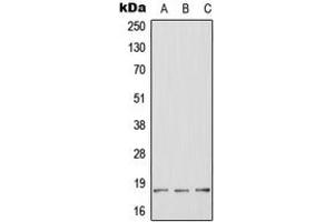 Western blot analysis of HES2 expression in HeLa (A), mouse brain (B), rat brain (C) whole cell lysates.