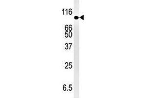 Image no. 1 for anti-SMAD Specific E3 Ubiquitin Protein Ligase 1 (SMURF1) (N-Term) antibody (ABIN357469) (SMURF1 Antikörper  (N-Term))