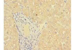 Immunohistochemistry of paraffin-embedded human liver tissue using ABIN7158927 at dilution of 1:100 (MR1 Antikörper  (AA 150-253))