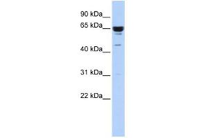 WB Suggested Anti-ZNF587 Antibody Titration:  0.