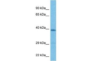 Host:  Rabbit  Target Name:  LAPTM4B  Sample Tissue:  Human MDA-MB-435s Whole Cell  Antibody Dilution:  1ug/ml (LAPTM4B Antikörper  (Middle Region))