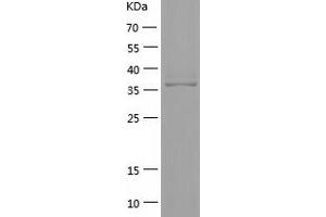 Western Blotting (WB) image for Eukaryotic Translation Initiation Factor 3, Subunit M (EIF3M) (AA 2-374) protein (His tag) (ABIN7122846) (Eukaryotic Translation Initiation Factor 3, Subunit M (EIF3M) (AA 2-374) protein (His tag))
