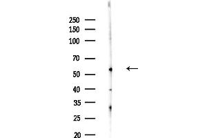 anti-Chaperonin Containing TCP1, Subunit 4 (Delta) (CCT4) (N-Term) antibody
