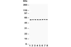 Western blot testing of Beclin 1 antibody and Lane 1:  COLO320;  2: HepG2;  3: PANC;  4: A431;  5: SMMC-7721;  6: Jurkat;  7: SW620;  8: U87 lysate. (Beclin 1 Antikörper  (AA 1-354))