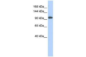 RNF31 antibody used at 1 ug/ml to detect target protein. (RNF31 Antikörper  (Middle Region))