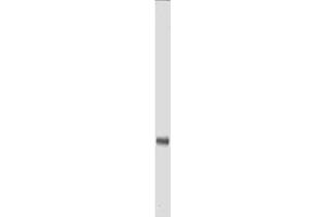 Anti-Myc epitope tag polyclonal antibody detects Myc-tagged recombinant proteins by western blot. (Myc Tag Antikörper  (Biotin))