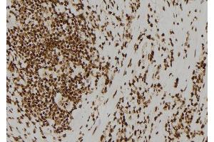 ABIN6278423 at 1/100 staining Human gastric tissue by IHC-P. (ASCL1 Antikörper  (C-Term))