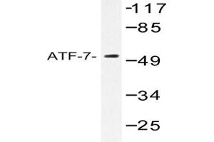 Image no. 1 for anti-Activating Transcription Factor 7 (AFT7) antibody (ABIN272174) (AFT7 Antikörper)