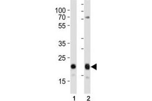 Western Blotting (WB) image for anti-CD9 (CD9) (AA 115-145) antibody (ABIN3028557)