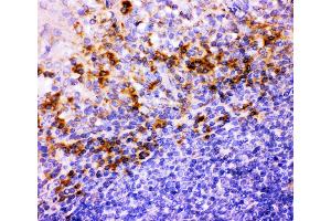 Anti-ITGB1 Picoband antibody,  IHC(P): Human Tonsil Tissue (ITGB1 Antikörper  (AA 527-728))