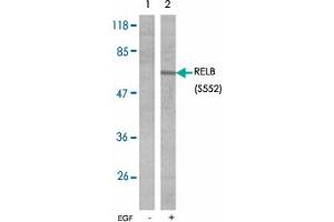 Western blot analysis of extracts from A431 cells untreated or treated with EGF (200 ng/mL 10 min) using RELB (phospho S552) polyclonal antibody . (RELB Antikörper  (pSer552))