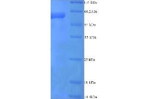 SDS-PAGE (SDS) image for Plasminogen Activator Inhibitor 2 (SERPINB2) (AA 1-416), (full length) protein (His tag) (ABIN5713824) (SERPINB2 Protein (AA 1-416, full length) (His tag))