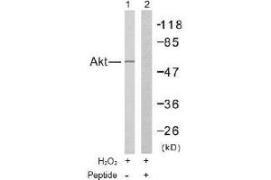 Image no. 2 for anti-V-Akt Murine Thymoma Viral Oncogene Homolog 1 (AKT1) (Thr308) antibody (ABIN197195) (AKT1 Antikörper  (Thr308))
