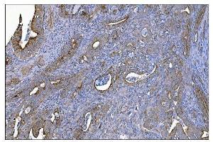 IHC analysis of MERTK using anti-MERTK antibody (ABIN7600623). (MERTK Antikörper  (AA 21-489))