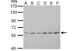 WB Image ASC1 antibody detects TRIP4 protein by Western blot analysis. (TRIP4 Antikörper)