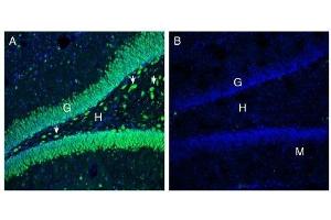 Immunohistochemistry (IHC) image for anti-ATPase, Na+/K+ Transporting, beta 3 Polypeptide (ATP1B3) (AA 66-80), (Extracellular) antibody (ABIN7042963)
