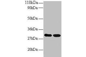 Western blot All lanes: ARHGEF18 antibody at 2 μg/mL Lane 1: EC109 whole cell lysate Lane 2: 293T whole cell lysate Secondary Goat polyclonal to rabbit IgG at 1/15000 dilution Predicted band size: 131, 115 kDa Observed band size: 30 kDa (ARHGEF18 Antikörper  (AA 159-551))