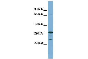 DHRS9 antibody used at 1 ug/ml to detect target protein. (DHRS9 Antikörper)