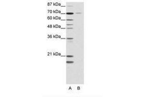 Image no. 1 for anti-Nuclear Receptor Subfamily 2, Group C, Member 1 (NR2C1) (AA 525-574) antibody (ABIN202801) (NR2C1 Antikörper  (AA 525-574))