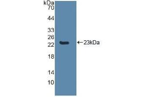 Western blot analysis of recombinant Human CASP8. (Caspase 8 Antikörper  (AA 217-384))