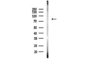 anti-Glutamine--Fructose-6-Phosphate Transaminase 1 (GFPT1) (N-Term) antibody