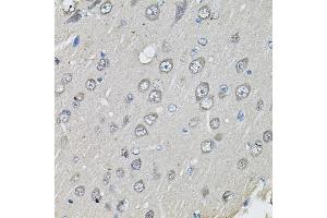 Immunohistochemistry of paraffin-embedded rat brain using CTNNB1 antibody (ABIN4903403) at dilution of 1:100 (40x lens). (CTNNB1 Antikörper)