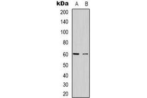 Western blot analysis of CABLES2 expression in Hela (A), Jurkat (B) whole cell lysates.