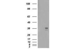 Image no. 2 for anti-Sirtuin 4 (SIRT4) (C-Term) antibody (ABIN374409) (SIRT4 Antikörper  (C-Term))